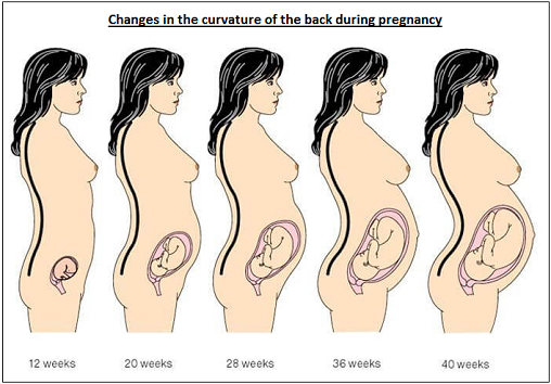  Curvature of the Back in  Pregnancy