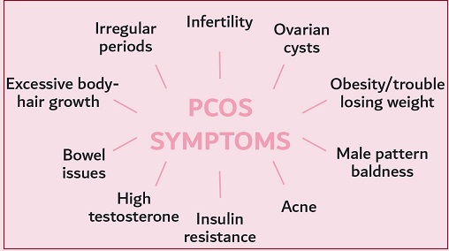  Symptoms of PCOS