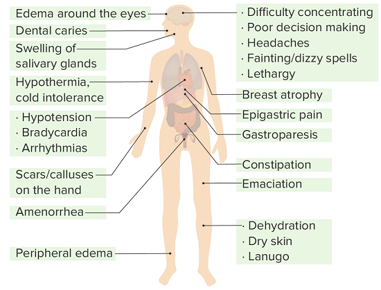 Symptoms of Anorexia Nervosa